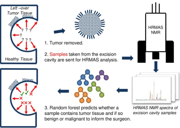 Fig 1. The figure shows the pipeline proposed for machine learning assisted tumor margin assessment during brain tumor surgery