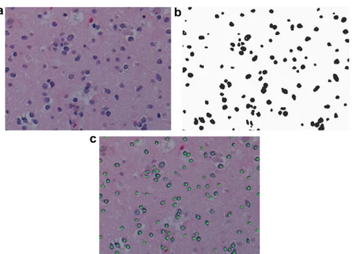 Fig. 1. Steps for the semi-automated cell segmentation: (a) start with the original tissue image, (b) threshold the pixels of the image and apply morphological operators, and (c) apply the watershed algorithm and if necessary, manually segment the cells.