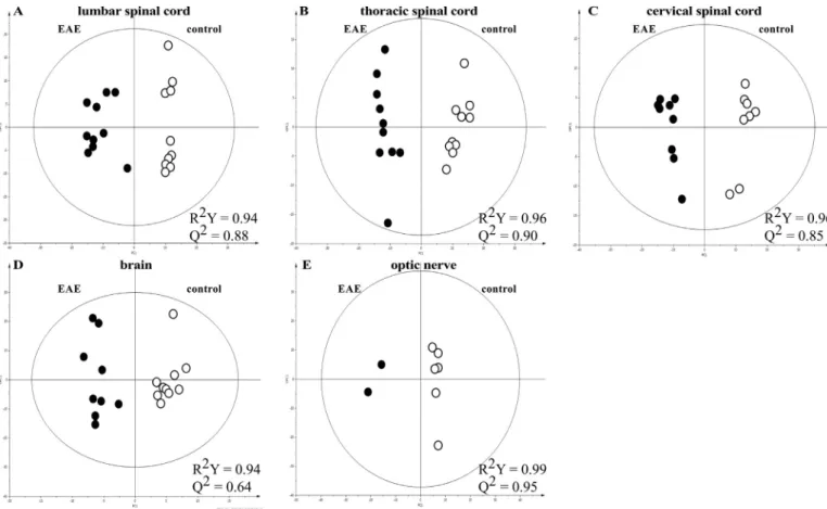 Fig. 1. Bi-component OPLS-DA models in lumbar (A), thoracic (B) and cervical (C) spinal cord, brain (D) and optic nerve (E): EAE group (full symbols) and control group (open symbols).