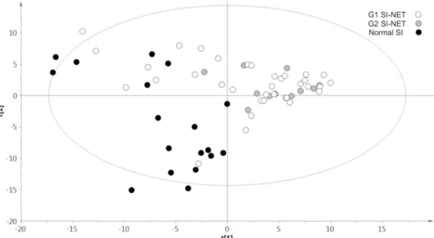 Figure 2. Results of three-class partial least squares discriminant analysis (PLS-DA) models  performed including grade 1 (G1) neuroendocrine tumors (NETs) (white circles), grade 2 (G2) NETs  (gray circles), and normal small-intestine tissue (black circles