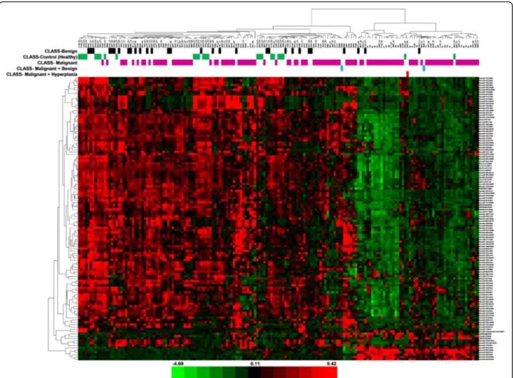 Fig. 3 Heat map − tumour type. The scaled expression of the differentially expressed microRNAs for 171 samples and the relationship among the samples in terms of microRNAs found to be differentially expressed for the tumour type factor; Significance Analys