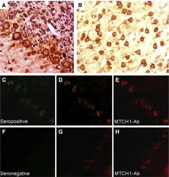 Fig. 3. Immunolabeling of frozen rat brain sections with mitochondrial carrier homolog 1 antibody (Mtch1-Ab) positive and negative sera of neuro-Behçet's disease (NBD) patients