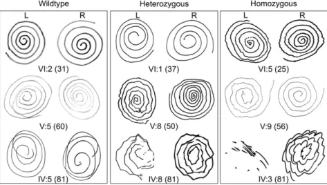 Fig. 2. Archimedes spiral tests of individuals of various ages and genotypes at HTRA2 p.G399S