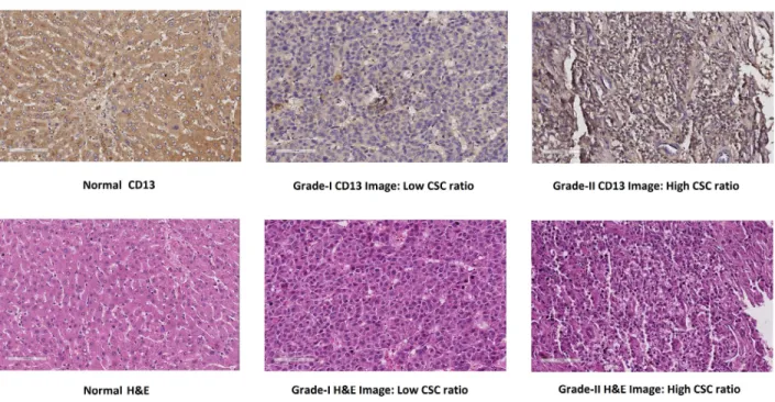 Figure 6. CD13 and H&amp;E image examples according to estimated CSC levels.