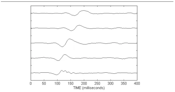 Figure 10. Average of last Korotkoff sounds recorded at rest and steps 1–4 of an exercise test