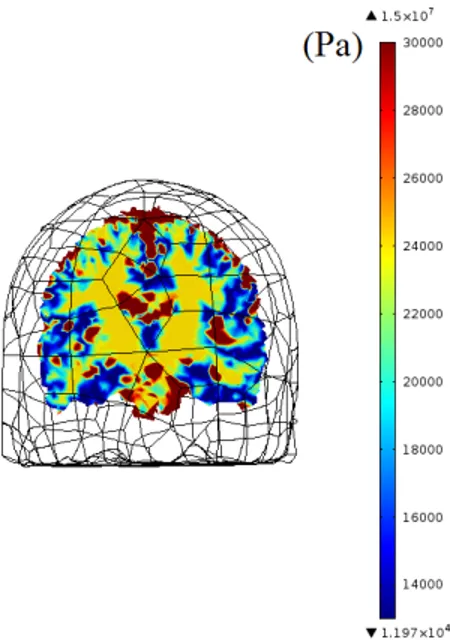 Figure 2.6: Young’s modulus (Pa) map of 3D brain model on coronal plane.