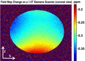 Fig. 5 Magnetic field changes in the x–z (coronal) plane after 1.7 h since cooling started on the 1.5 T Siemens system