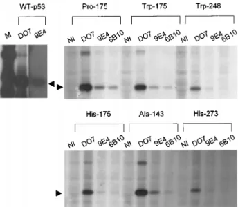 Figure 1 Immunoreactivities of 6B10, 7D3 and 9E4 monoclonal antibodies with wild-type and mutant p53 protein as tested by Western immunoblotting