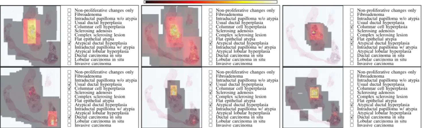 Fig. 1. Viewing behavior of six different pathologists on a whole slide image with a size of 74896 × 75568 pixels
