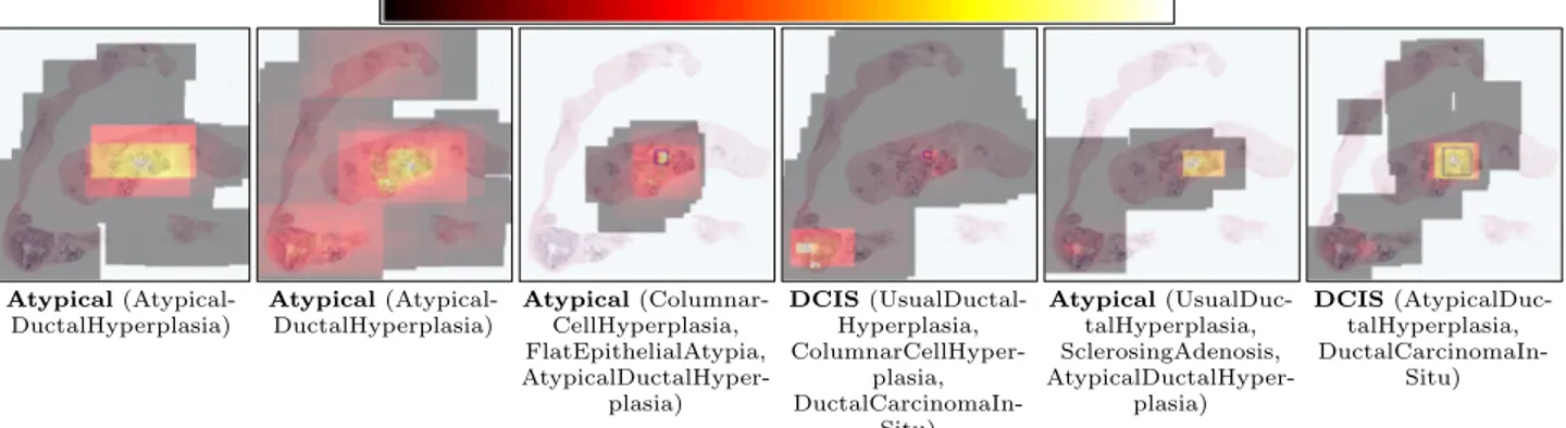 Figure 1. Viewing behavior of six different pathologists on a whole slide image with a size of 75568 × 74896 pixels