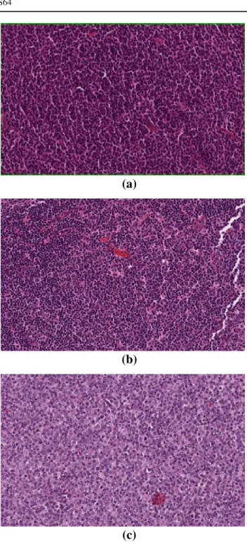 Fig. 1 Example images for grades one, two, and three of follicular lymphoma. a Grade 1, b Grade 2, c Grade 3