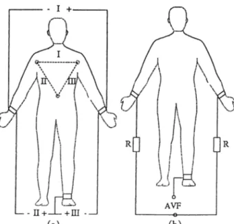 Figure  1.1:  The  acquirement  of a.  bipolar  signals,  b.  A V F   lead  signal.