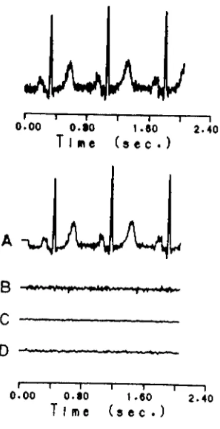 Figure  2.2:  Sub-band  signals  at  the  outputs  of analysis  bank  of the  QMF.