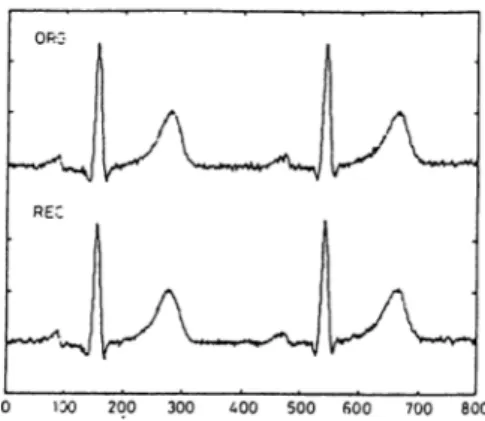 Figure  2.6:  Original  and  the  reconstructed  ECG  signals  with  CR=5.7  and  PRD=7.0%.
