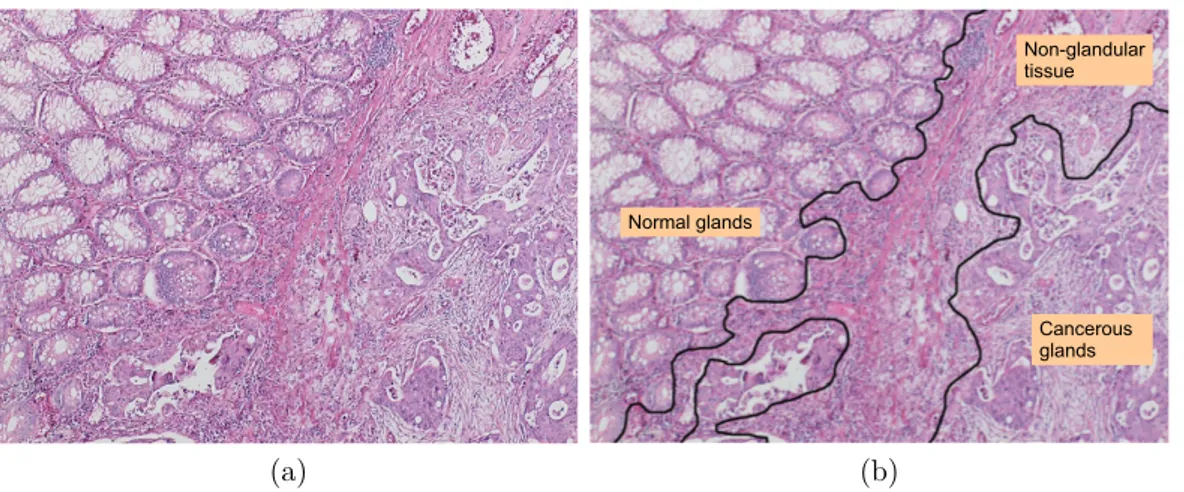 Figure 1.1: A colon tissue may consist of different types of regions: (a) a colon tissue image and (b) its manual segmentation.