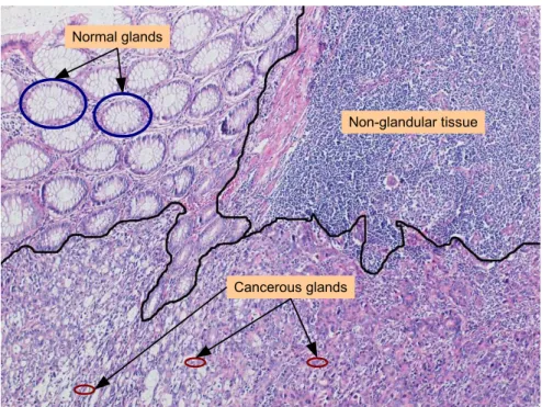 Figure 1.2: Heterogeneous histopathological images are composed of different regions.