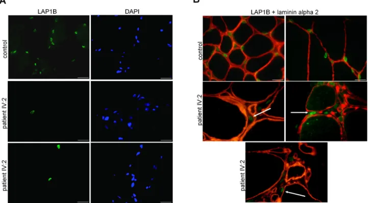 Fig. 2. Immunoﬂuorescent staining of skeletal muscle sections. (A) Immunolocalization of LAP1B