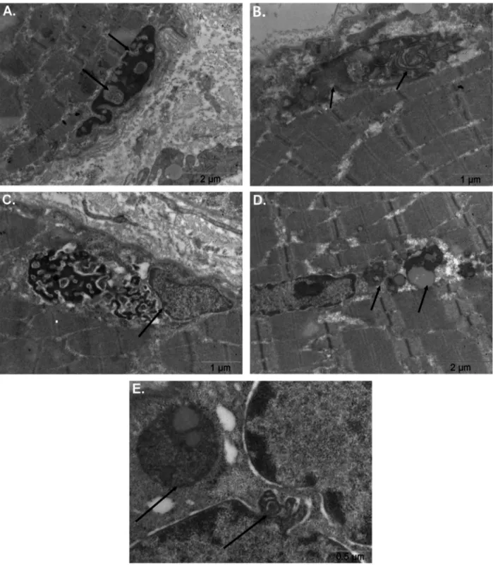 Fig. 3. Ultrastructural alterations of the nuclear envelope. (A) Nuclear fragmentation and chromatin bleb formation (arrow)