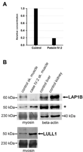 Fig. 5. Expression analysis. (A) Analysis of TOR1AIP1 mRNA expression via qRT-PCR. Primers bridging exon 1 and exon 2 of TOR1AIP1 and primers speciﬁc to ACTB were used and the experiments were performed in triplicate
