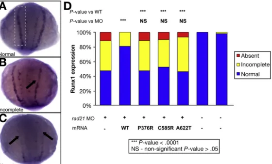 Figure 2. RAD21 A622T affects runx1 expression in zebra ﬁsh embryos. runx1 expression in the posterior lateral plate mesoderm in rad21a MO-injected embryos rescued with wild-type or mutant RAD21