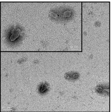 Fig. 1 Transmission electron microscopy of UDL-5FU following negative staining (×100,000)