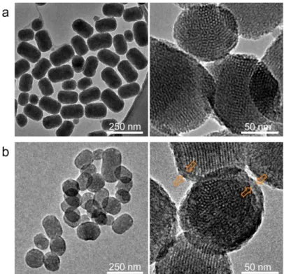 Figure 3.2: TEM images of the ultrabright MSNs; (a) rMSN and (b) rMSN-ts. Left and right  panels  shows  the  low  and  high  magnification  images  of  the  particles,  respectively