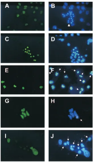 Figure 1. Initial characterization of NAPO antigen. Anti-NAPO  monoclonal antibody recognizes two bands migrating at 60 and  70 kD