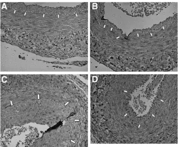 FIGURE 6. Photomicrographs showing representative cross sections of interpositional vein grafts