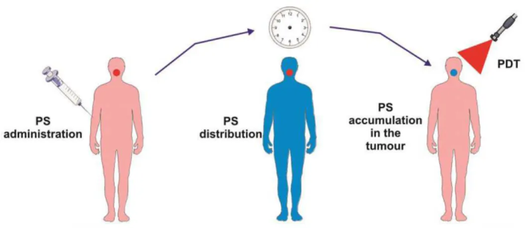 Figure  1:  The  Principles  of  Photodynamic  Therapy  (PDT). 8   Copyright  ©  2011  American Cancer Society