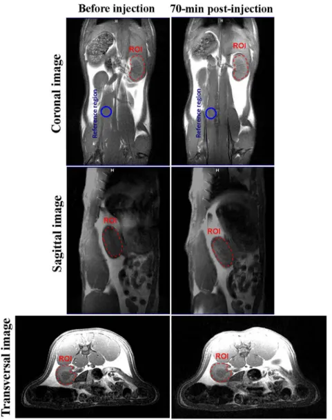 Fig. 5. In-vivo T 1 -weighted spin-echo MRI images of a healthy rat, acquired on a 3T MRI scanner