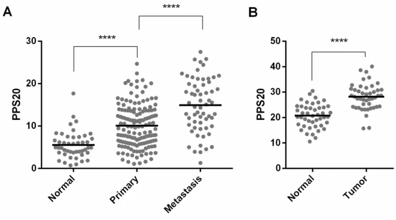 Fig 4. PPS20 is significantly different between normal, tumor and metastatic tissues. PPS20 in normal (n = 46), primary (n = 145) and metastasic tissues (n = 61) of GSE71729 (A)