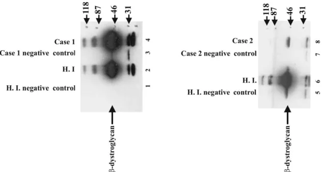 Fig. 5. Co-immunoprecipitation of b-dystroglycan with a-dystroglycan. b-Dystroglycan protein is co-immunoprecipitated with a-dystroglycan by using form of a-dystroglycan