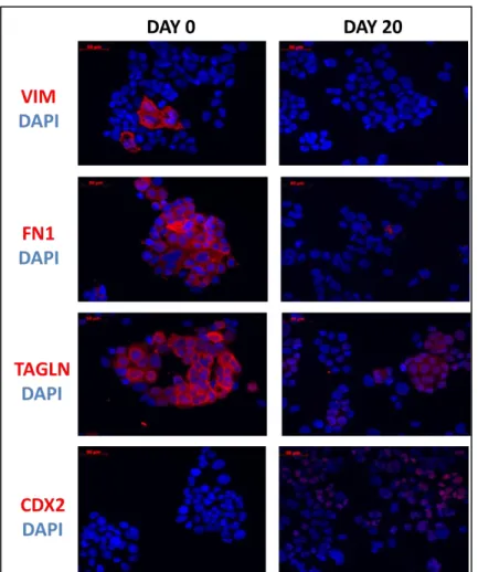 Figure 3.1.2 3: Decrease in mRNA levels of mesenchymal marker genes (VIM, FN1  and TAGLN) and increase in mRNA level of epithelial marker gene (CDX2) exist in  protein level as well