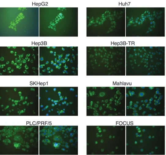 Table 1. Subcellular Dstribution of p33ING1 in Relation to p53 Status of Hepatoma Cells