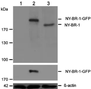 FIGURE 2. Different dilutions of anti-NY-BR-1 supernatants were tested against the recombinant NY-BR-1 protein  (aa701-1397) in Western blot (lanes 1 to 4 supernatant at 1:250, 1:500, 1:1000, and 1:2000 dilutions, 5 representing the negative control using 
