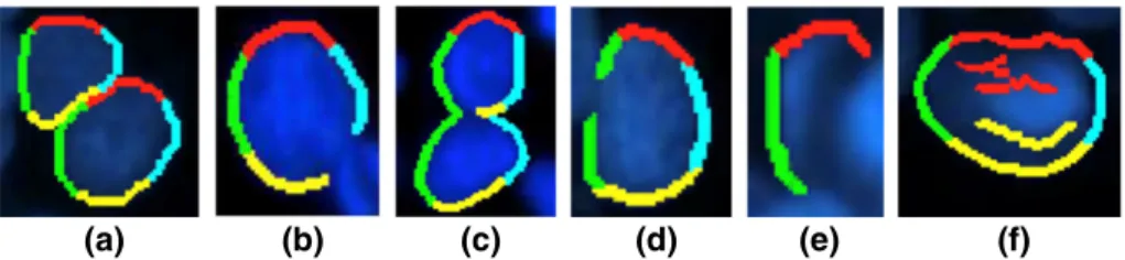Figure 1. Illustrations of (a) the hypothetical case and (b–f) the nonideal conditions for the edge-object deﬁnition
