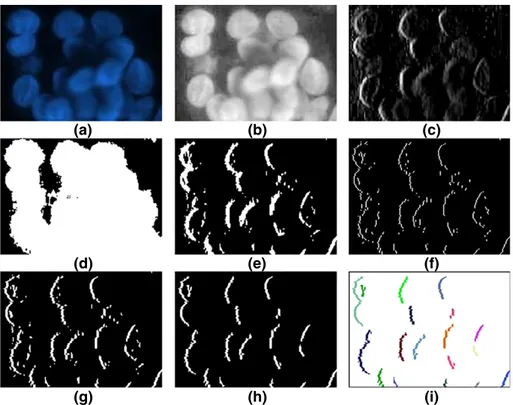 Figure 2. Left edge-object deﬁnition on an example subimage: (a) original subimage obtained from the HepG2 liver cancer cell line, (b) its L channel, (c) gradient map G left obtained by convolution, (d) binary mask B, (e) binary edge map obtained after thr