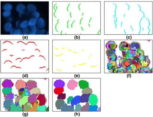 Figure 4. Illustration of the edge-objects and the subregions before and after merging: (a) original subimage obtained from the HepG2 liver cancer cell line, (b) left edge-objects, (c) right edge-objects, (d) top edge-objects, (e) bottom edge-objects, (f) 