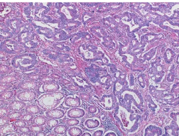 Fig. 1. A histopathological image stained with the hematoxylin-and-eosin technique.