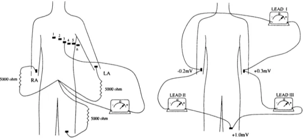 Figure  1 . 1 :  Standard  leads  used  in  ECG  recording 