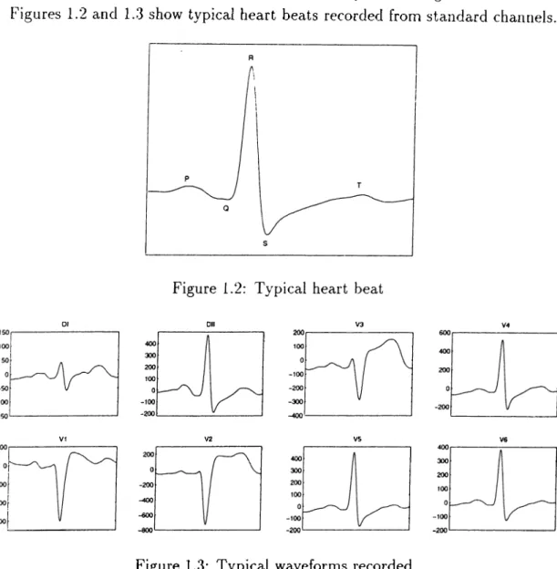 Figure  1.3:  Typical  waveforms  recorded