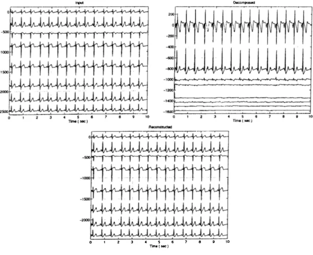 Figure  2.1:  Input,  decomposed  and  reconstructed  signals  (The  input  and  reconstructed  channels  are 