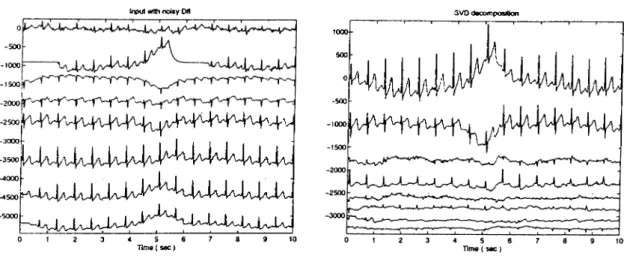 Figure  2.7:  Input  and  decomposed  signals  when  DII  is  noisy