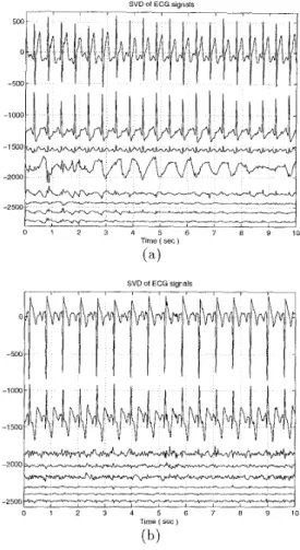 Figure  2:  ( a )   SVD  Of ECG  With  U W   (b)  SVD Of ECG  With  EMG 