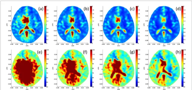 Figure 12.  Noise analysis of the brain phantom: (a)–(d) combined conductivity and (e)–(h) combined relative permittivity  reconstructions for K values of 200, 300, 400 and  1 × 10 6  (no noise) respectively.