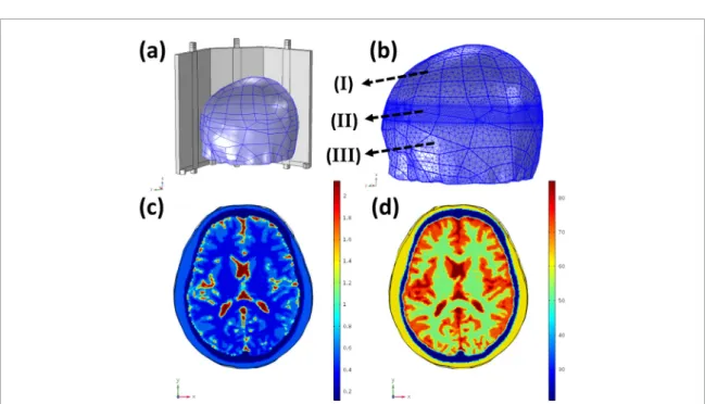 Figure 3.  The localization and mesh distribution of the brain phantom in (a) and (b), respectively
