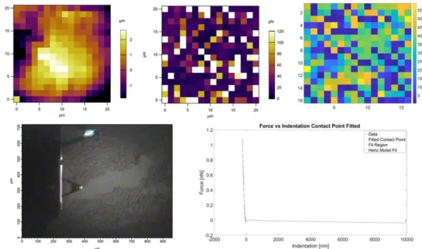 Figure 2.5. Young’s modulus distribution of deparaffinized kidney tissue.  