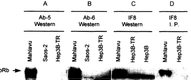 Fig.  7. The  absence  of  detectable  retinoblastoma  protein  (pRb)  in  Hep3B  and  Hep3B-TR  cells
