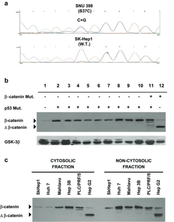 Figure 1 (a) b-catenin mutation status of hepatocellular carcinoma cell lines. Direct sequencing of exon 3 and fragment length analysis of exons 2 – 4 of genomic DNAs from 12 cell lines showed a point mutation in SNU398 (top), but not in other cell lines (