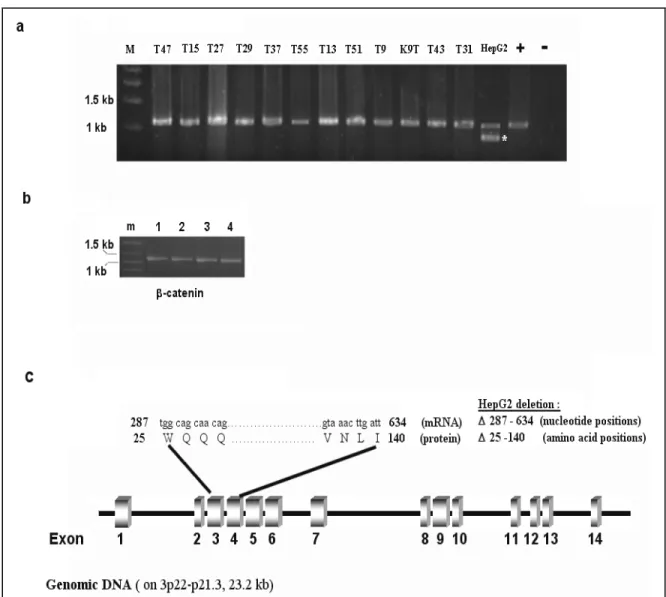 Figure 9        Large deletion analysis in  β-catenin gene by PCR of genomic DNA  β